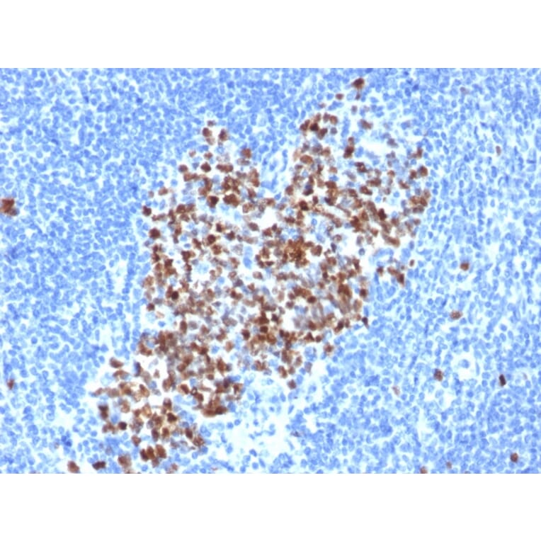 Immunohistochemistry - Anti-Topoisomerase II alpha Antibody [rTOP2A/6569] - BSA and Azide free (A278513) - Antibodies.com