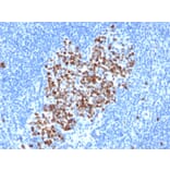 Immunohistochemistry - Anti-Topoisomerase II alpha Antibody [rTOP2A/6569] - BSA and Azide free (A278513) - Antibodies.com