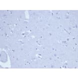 Immunohistochemistry - Anti-Topoisomerase II alpha Antibody [rTOP2A/6569] - BSA and Azide free (A278513) - Antibodies.com