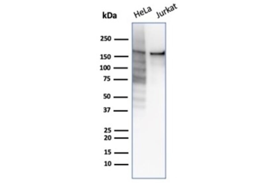 Western Blot - Anti-Topoisomerase II alpha Antibody [rTOP2A/6569] - BSA and Azide free (A278513) - Antibodies.com