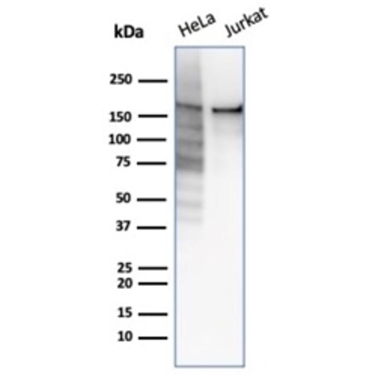 Anti Topoisomerase Ii Alpha Antibody Rtop2a6569 A278513