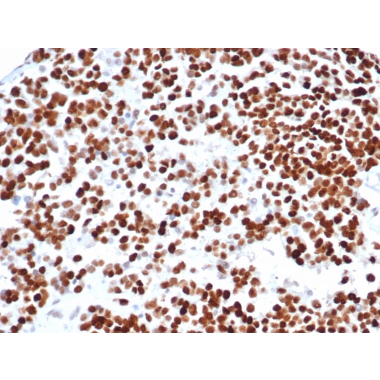 Immunohistochemistry - Anti-p53 Antibody [rTP53/6927] - BSA and Azide free (A278514) - Antibodies.com