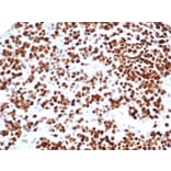 Immunohistochemistry - Anti-p53 Antibody [rTP53/6927] - BSA and Azide free (A278514) - Antibodies.com