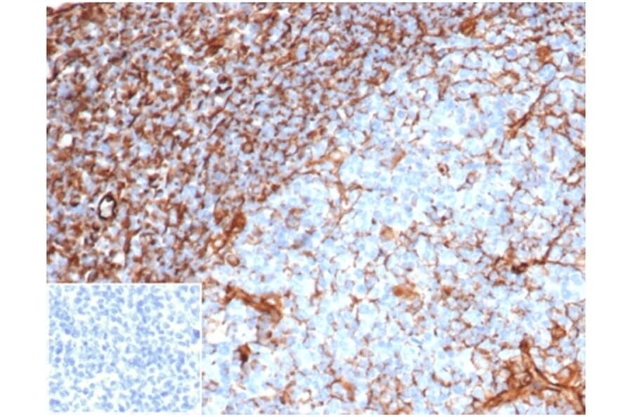 Immunohistochemistry - Anti-Vimentin Antibody [rVIM/6914] - BSA and Azide free (A278515) - Antibodies.com