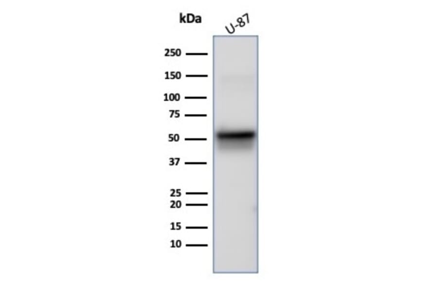 Western Blot - Anti-Vimentin Antibody [rVIM/6914] - BSA and Azide free (A278515) - Antibodies.com