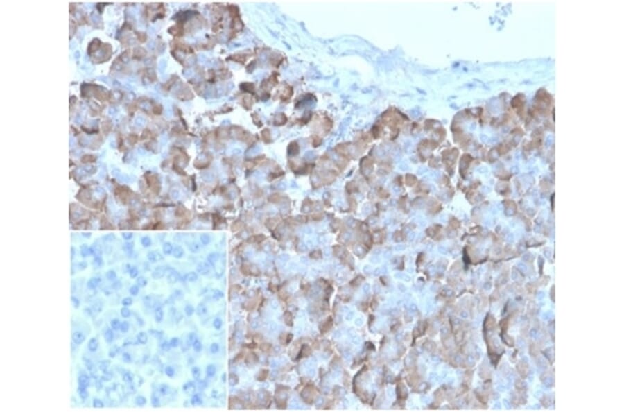 Immunohistochemistry - Anti-VLDL Receptor Antibody [rVLDLR/1337] - BSA and Azide free (A278516) - Antibodies.com