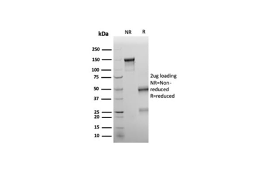 SDS-PAGE - Anti-Wilms Tumor Protein Antibody [rWT1/6908] - BSA and Azide free (A278517) - Antibodies.com