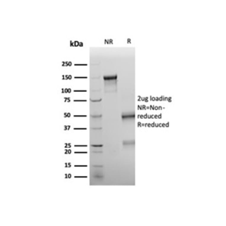 SDS-PAGE - Anti-Wilms Tumor Protein Antibody [rWT1/6908] - BSA and Azide free (A278517) - Antibodies.com