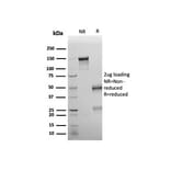SDS-PAGE - Anti-Wilms Tumor Protein Antibody [rWT1/6908] - BSA and Azide free (A278517) - Antibodies.com