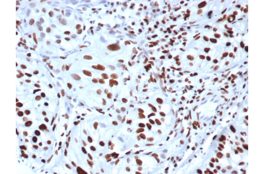 Immunohistochemistry - Anti-Histone H3 (phospho Ser10) Antibody [rPHH3/6824] - BSA and Azide free (A278518) - Antibodies.com