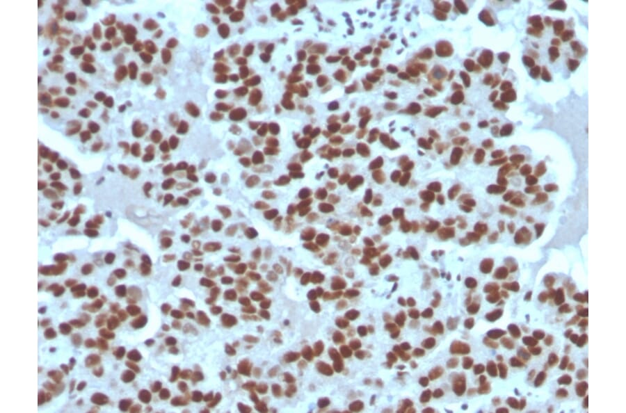 Immunohistochemistry - Anti-Cyclin E1 Antibody [rCCNE1/4936] - BSA and Azide free (A278519) - Antibodies.com
