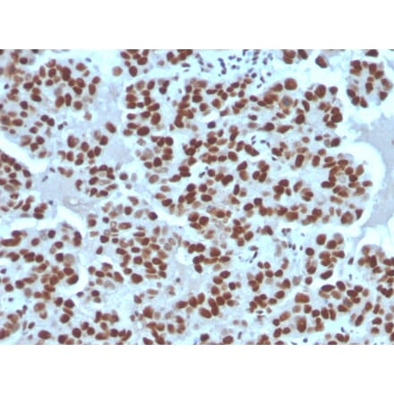 Immunohistochemistry - Anti-Cyclin E1 Antibody [rCCNE1/4936] - BSA and Azide free (A278519) - Antibodies.com