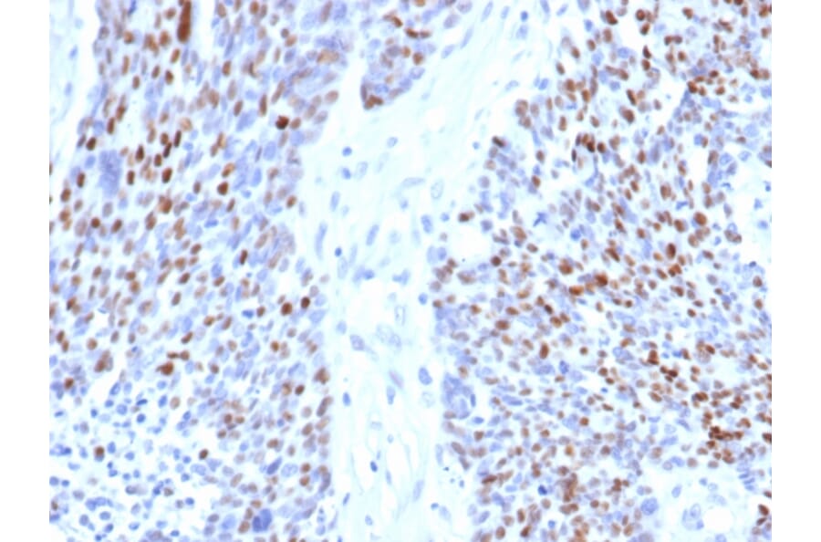 Immunohistochemistry - Anti-Cyclin E1 Antibody [rCCNE1/4936] - BSA and Azide free (A278519) - Antibodies.com
