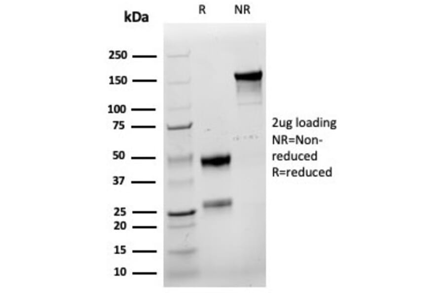 SDS-PAGE - Anti-Cyclin E1 Antibody [rCCNE1/4936] - BSA and Azide free (A278519) - Antibodies.com