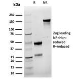 SDS-PAGE - Anti-Cyclin E1 Antibody [rCCNE1/4936] - BSA and Azide free (A278519) - Antibodies.com