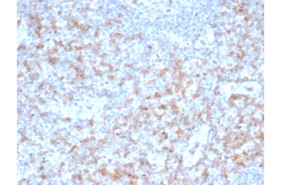 Immunohistochemistry - Anti-CD5 Antibody [rC5/6462] - BSA and Azide free (A278520) - Antibodies.com