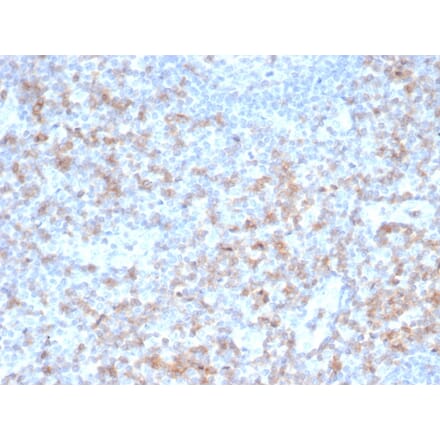 Immunohistochemistry - Anti-CD5 Antibody [rC5/6462] - BSA and Azide free (A278520) - Antibodies.com