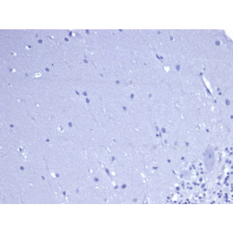 Immunohistochemistry - Anti-CD5 Antibody [rC5/6462] - BSA and Azide free (A278520) - Antibodies.com