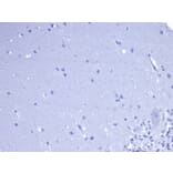 Immunohistochemistry - Anti-CD5 Antibody [rC5/6462] - BSA and Azide free (A278520) - Antibodies.com