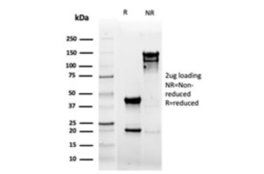 SDS-PAGE - Anti-CD5 Antibody [rC5/6462] - BSA and Azide free (A278520) - Antibodies.com