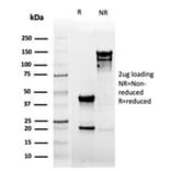 SDS-PAGE - Anti-CD5 Antibody [rC5/6462] - BSA and Azide free (A278520) - Antibodies.com