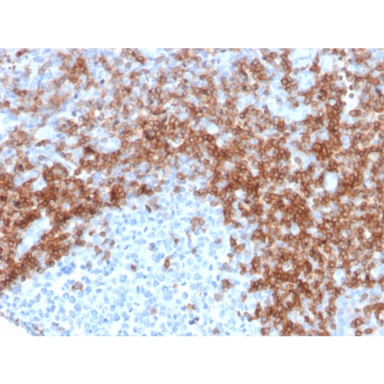 Immunohistochemistry - Anti-CD5 Antibody [rC5/6429] - BSA and Azide free (A278521) - Antibodies.com