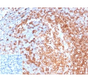 Immunohistochemistry - Anti-CD22 Antibody [rBLCAM/6749] - BSA and Azide free (A278522) - Antibodies.com