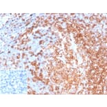 Immunohistochemistry - Anti-CD22 Antibody [rBLCAM/6749] - BSA and Azide free (A278522) - Antibodies.com