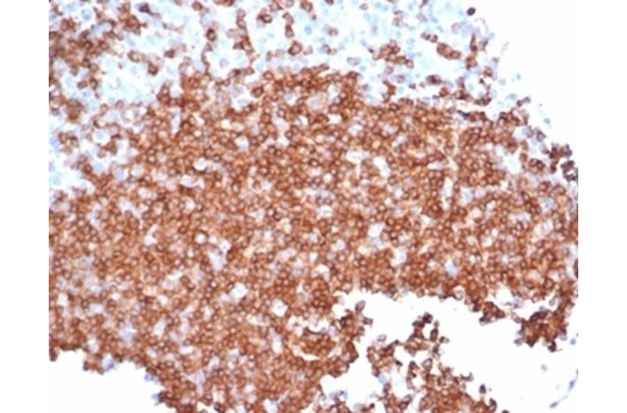 Immunohistochemistry - Anti-CD22 Antibody [rBLCAM/6749] - BSA and Azide free (A278522) - Antibodies.com