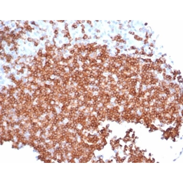 Immunohistochemistry - Anti-CD22 Antibody [rBLCAM/6749] - BSA and Azide free (A278522) - Antibodies.com