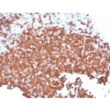Immunohistochemistry - Anti-CD22 Antibody [rBLCAM/6749] - BSA and Azide free (A278522) - Antibodies.com