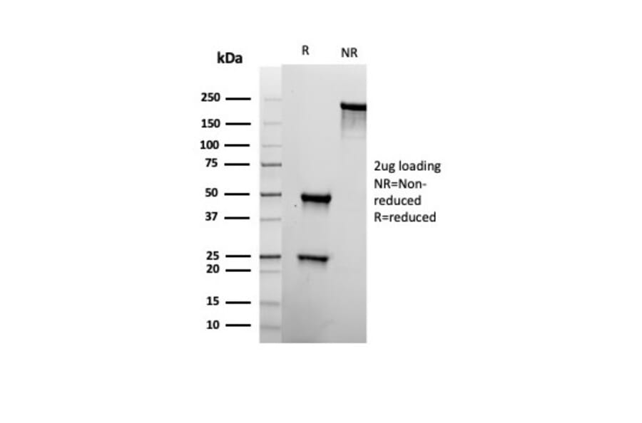 SDS-PAGE - Anti-CD22 Antibody [rBLCAM/6749] - BSA and Azide free (A278522) - Antibodies.com