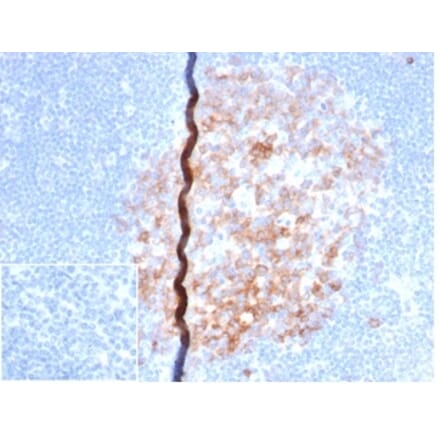 Immunohistochemistry - Anti-CD86 Antibody [rC86/6872] - BSA and Azide free (A278523) - Antibodies.com