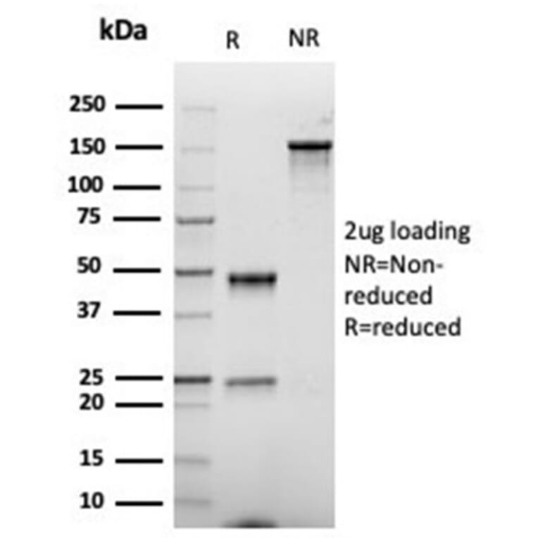 SDS-PAGE - Anti-CD86 Antibody [rC86/6872] - BSA and Azide free (A278523) - Antibodies.com