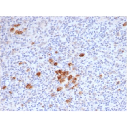 Immunohistochemistry - Anti-CD30 Antibody [rKi-1/6913] - BSA and Azide free (A278524) - Antibodies.com