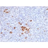 Immunohistochemistry - Anti-CD30 Antibody [rKi-1/6913] - BSA and Azide free (A278524) - Antibodies.com