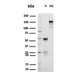 SDS-PAGE - Anti-CD30 Antibody [rKi-1/6913] - BSA and Azide free (A278524) - Antibodies.com
