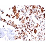 Immunohistochemistry - Anti-NAPSIN A Antibody [rNAPSA/6926] - BSA and Azide free (A278525) - Antibodies.com
