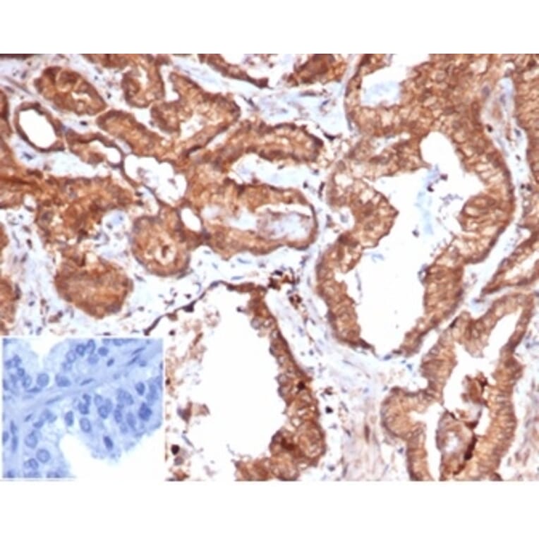 Immunohistochemistry - Anti-CD47 Antibody [rCD47/6365] - BSA and Azide free (A278526) - Antibodies.com