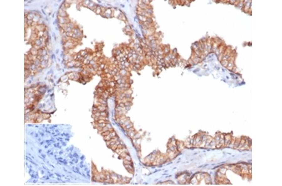 Immunohistochemistry - Anti-CD47 Antibody [rCD47/6589] - BSA and Azide free (A278527) - Antibodies.com