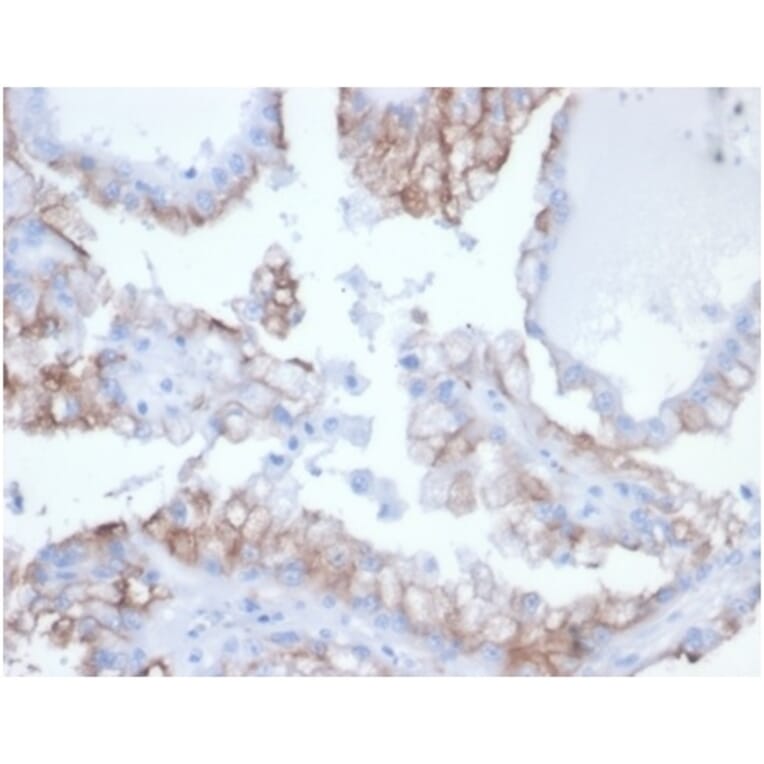 Immunohistochemistry - Anti-CDC20 Antibody [rCDC20/7184] - BSA and Azide free (A278528) - Antibodies.com