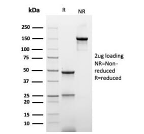 SDS-PAGE - Anti-His Tag Antibody [r6HIS/6423] - BSA and Azide free (A278529) - Antibodies.com