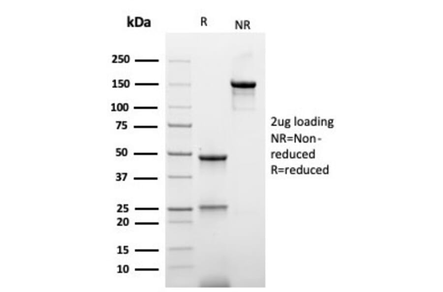 SDS-PAGE - Anti-His Tag Antibody [r6HIS/6423] - BSA and Azide free (A278529) - Antibodies.com