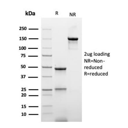 SDS-PAGE - Anti-His Tag Antibody [r6HIS/6423] - BSA and Azide free (A278529) - Antibodies.com