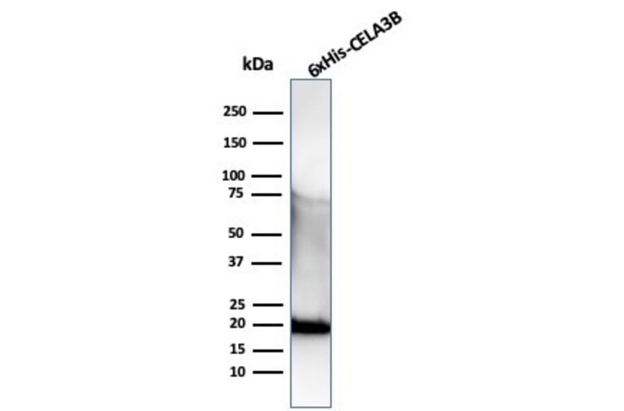 Western Blot - Anti-His Tag Antibody [r6HIS/6423] - BSA and Azide free (A278529) - Antibodies.com