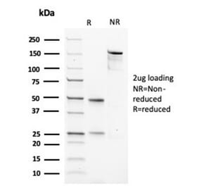 SDS-PAGE - Anti-Muscle Actin Antibody [rMSA/953] - BSA and Azide free (A278531) - Antibodies.com