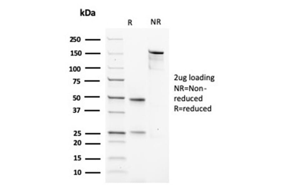 SDS-PAGE - Anti-Muscle Actin Antibody [rMSA/953] - BSA and Azide free (A278531) - Antibodies.com