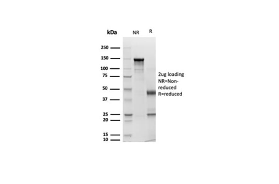 SDS-PAGE - Anti-pan Cytokeratin Antibody [Cocktail rPCK/6750] - BSA and Azide free (A278532) - Antibodies.com
