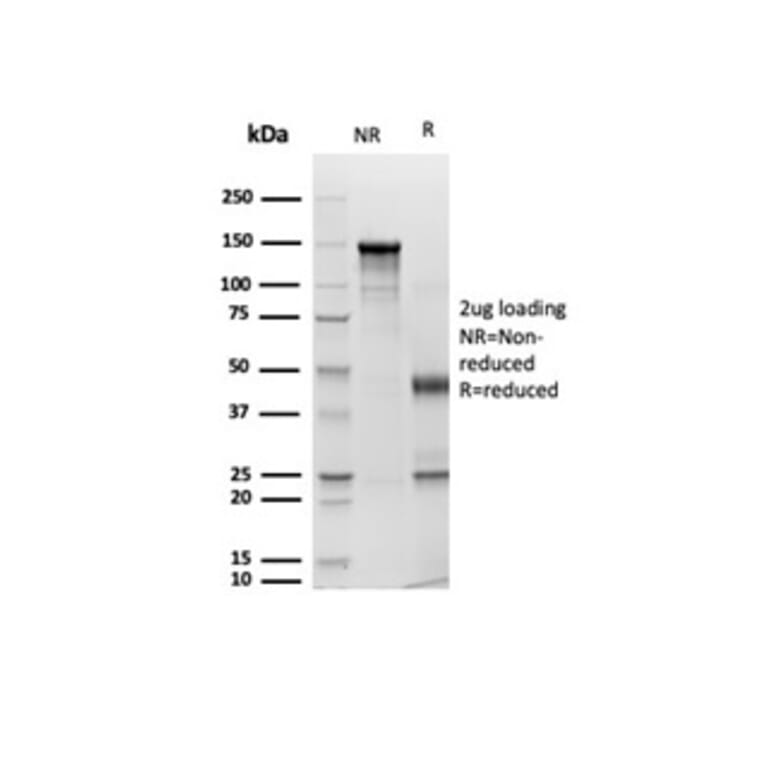 SDS-PAGE - Anti-pan Cytokeratin Antibody [Cocktail rPCK/6750] - BSA and Azide free (A278532) - Antibodies.com