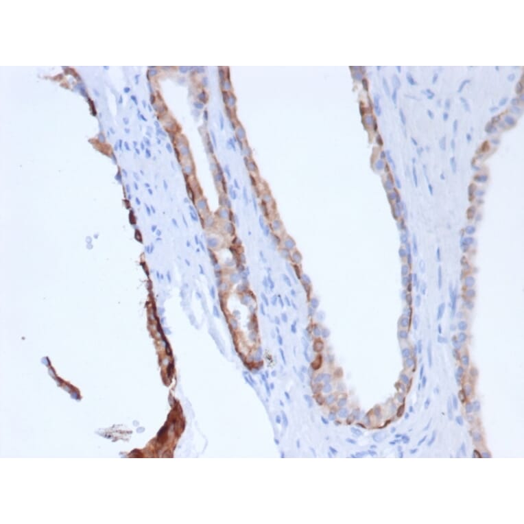 Immunohistochemistry - Anti-pan Cytokeratin Antibody [Cocktail rPCK/6750] - BSA and Azide free (A278532) - Antibodies.com